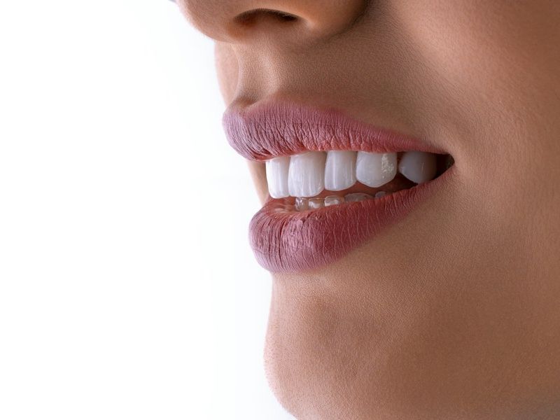 Close-up of a bright, white smile