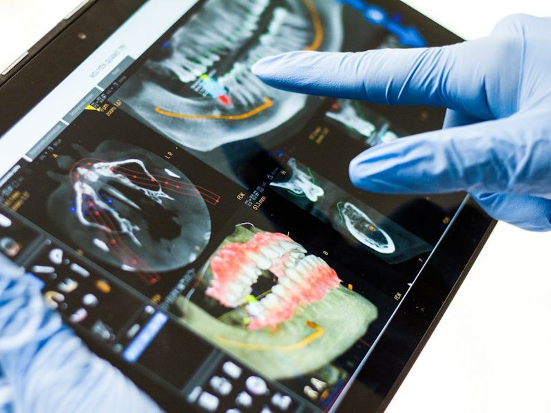 Dental 3D scan reviewed on a tablet
