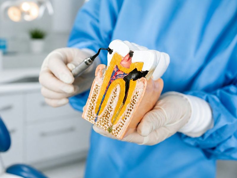 Dentist holding a cross-section model of a tooth